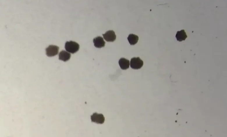 Anthrobots: How Tiny Robots Made from Human Cells Are Revolutionizing Medicine